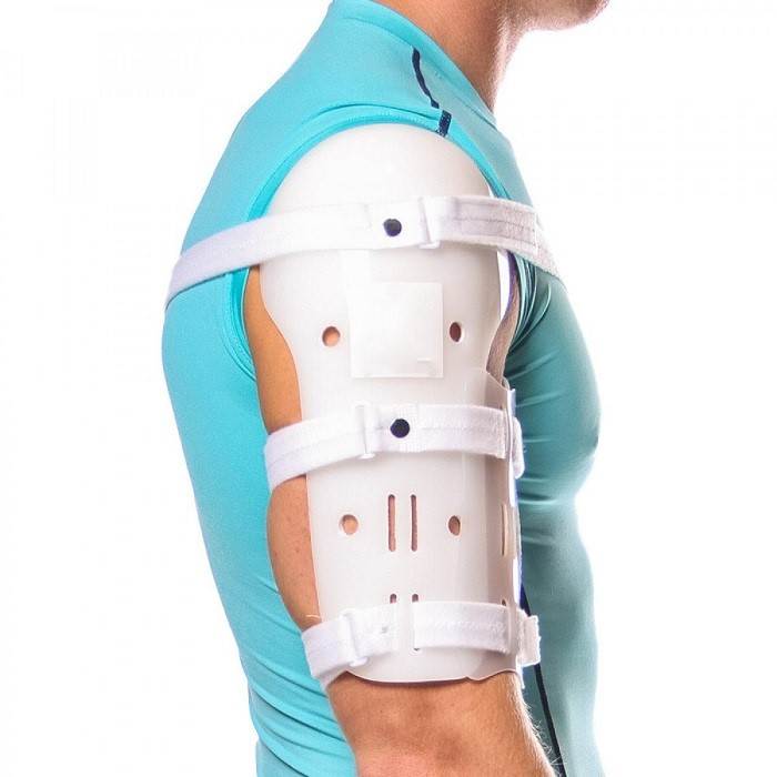 سارمینتو درمان شکستگی استخوان بازو با بریس سارمینتو - شکستگی بازو و ساعد