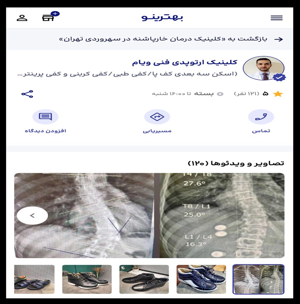 بهترین کلینیک ارتوپدی فنی تهران 1009x1024 - بهترین کلینیک ارتوپدی فنی تهران